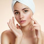 Effective oily skin treatments for acne-prone skin Strategies for Clear, Healthy Skin