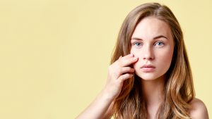 How to Get Rid of Acne Scars?