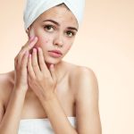 How to Get Rid of Acne Scars?