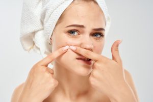 How to Get Rid of Acne Scars?